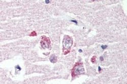 GPR98 Antibody, Novus Biologicals 50 &mu;g | Buy Online | Bio-Techne | Fisher Scientific